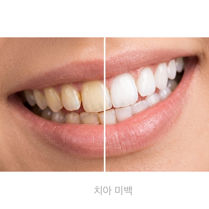 착한치과의원 미백 치료 공간