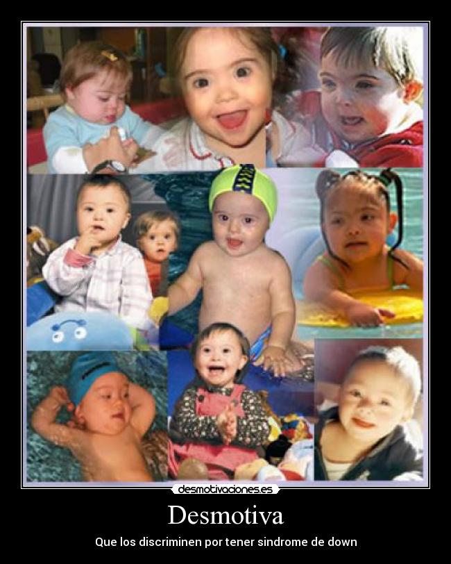 carteles sindrome down desmotivaciones