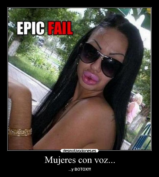 Mujeres con voz... - ...y BOTOX!!!