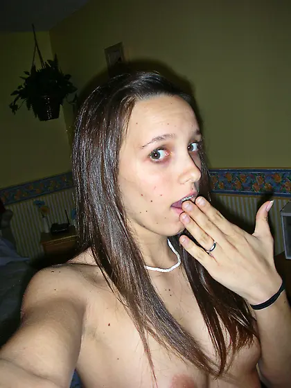 braces