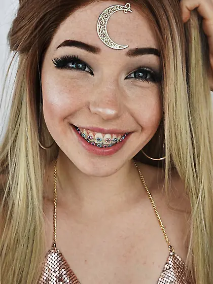 braces