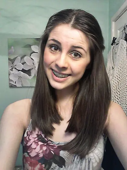 braces