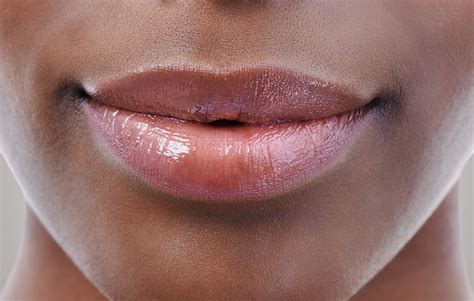 White Pimple In My Lip - Infoupdate Wallpaper Images