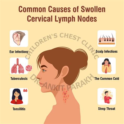 What are the common causes of enlarged cervical lymph nodes in children - Dr. Ankit Parakh