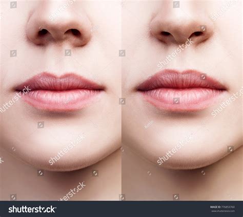 Front View On Female Nose Before Stock Photo 776853760 | Shutterstock