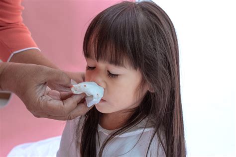 How to Stop Nose Bleeding for Children?