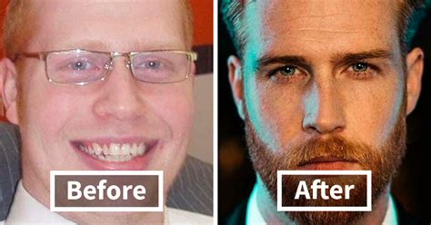 30 Men Who Are Now Rocking A Bearded Look Share How They Looked Before | Bored Panda