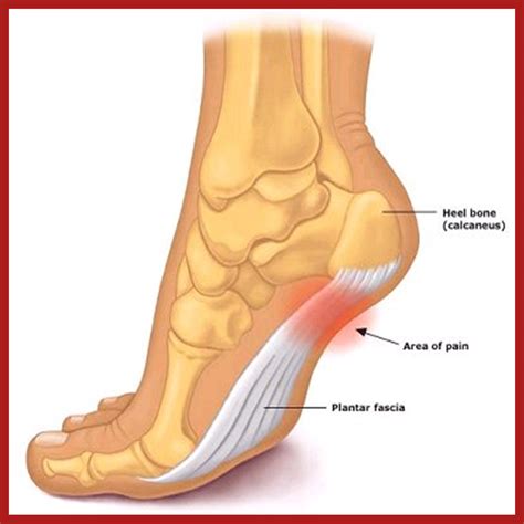 Foot Pain Chart