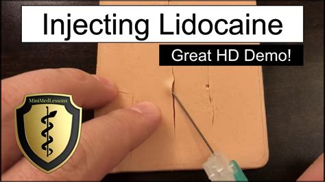 Injecting Lidocaine for a Laceration - HD Video Demonstration! - YouTube