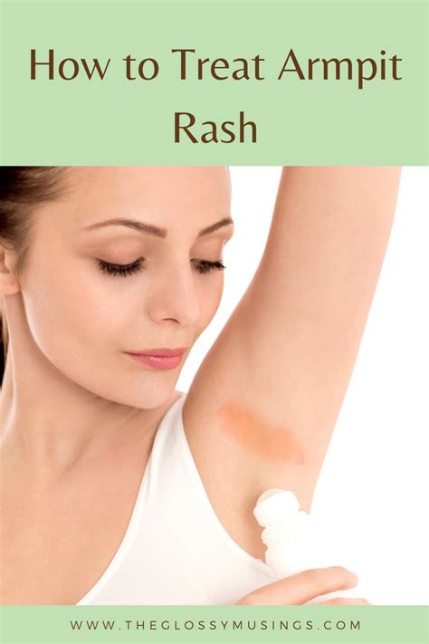 How To Get Rid Of Armpit Rash In 2021 Armpit Rash Rashes Fungal Rash – Theme Loader