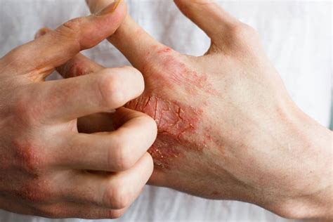 Five Reasons Why People May Develop Skin Problems - Health2wellness