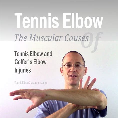 Tennis Elbow Classroom: The Muscular Causes Of Tennis And Golfer's Elbow - Tennis Elbow 101