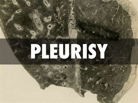 Pleurisy: 10 Pleurisy Symptoms