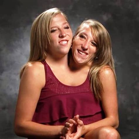 Conjoined twins Abby and Brittany Hensel married | Siamesische zwillinge, Zwillinge, Siamesisch