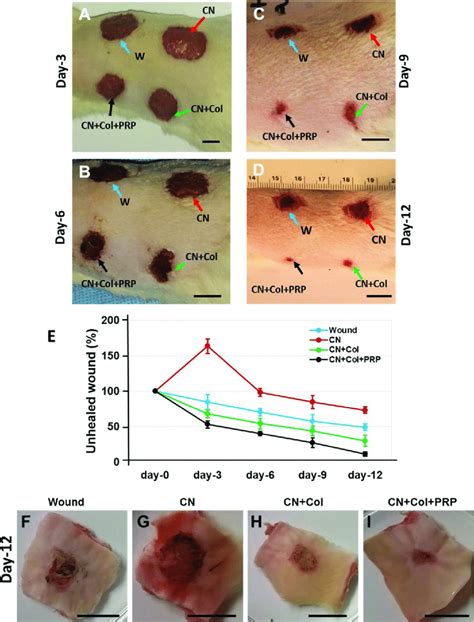 Healing stages of the skin wounds with four different treatments during... | Download Scientific ...