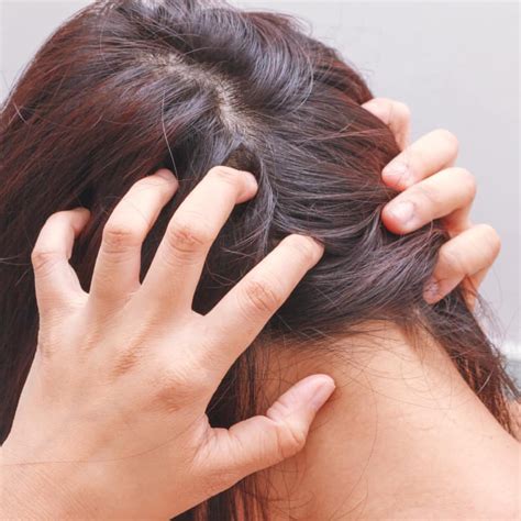 Best Home Remes For Scalp Ringworm - Homemade Ftempo