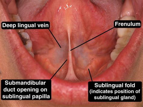 Struggling with Sublingual : r/AskMtFHRT