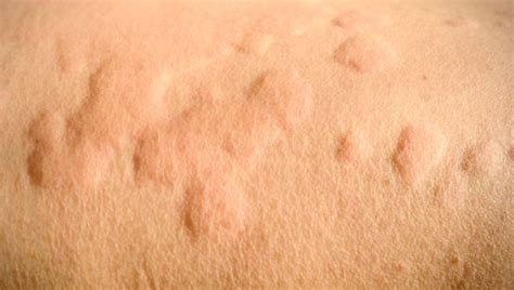 Common Causes Of Itchy Red Bumps On Skin | The Best Porn Website