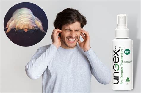 Ear Mites in Humans: Kinds, Signs, Prevention, and Remedy | Ungex