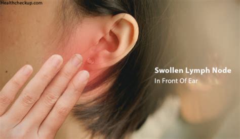 Swollen Lymph Node In Front of Ear - Causes, Treatment, Home Remedies