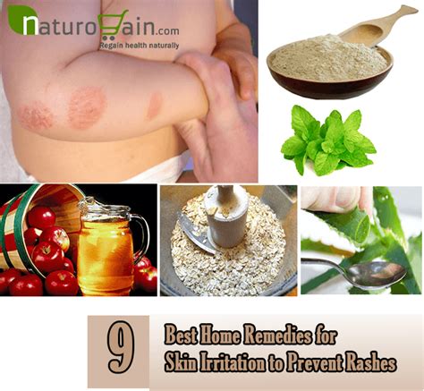 9 Best Home Remedies for Skin Irritation to Prevent Rashes