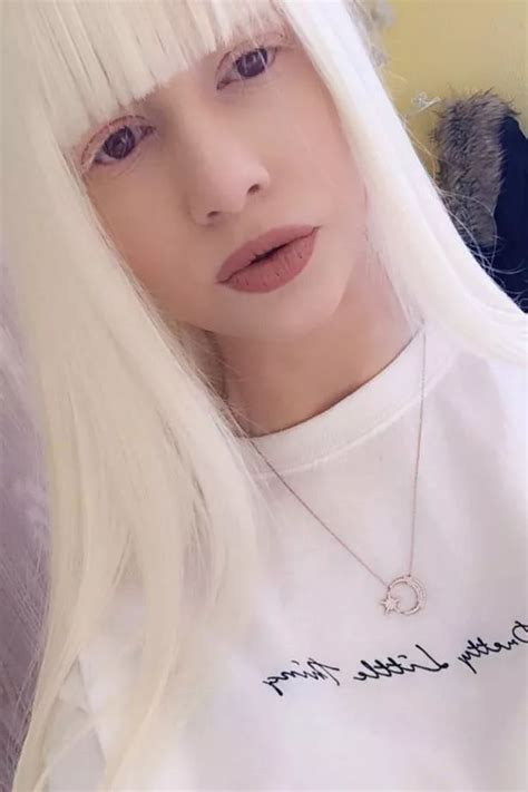 Albino Yorkshire girl speaks out on being 'spat on' and abused in the street - Leeds Live