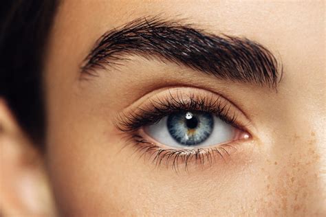 What Are Eye Freckles? Causes, Symptoms, and Treatment