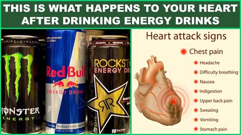 These Are The Horrific Side-Effects of Energy Drinks On Your Body