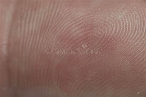 A Fingerprint is a Trace Left by the Dermatoglyphics of the Last Phalanx of the Fingers Stock ...