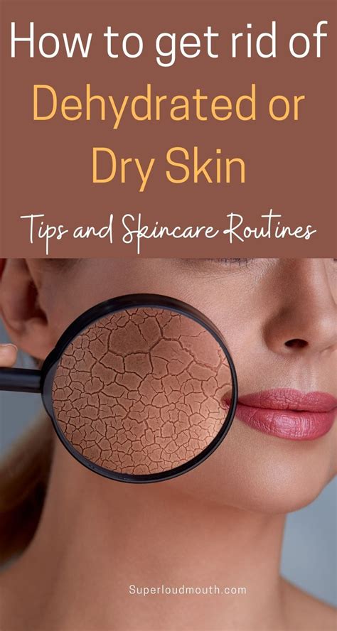 How to treat Dry and Dehydrated Skin Dehydrated Skin Remedies, Skin Care Remedies, Dry Face Skin ...