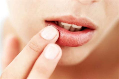 Lip Allergy: Cause, Symptoms, Treatment and Prevention of Lip Allergy