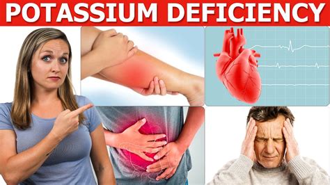 Low Potassium: Signs, Symptoms, Causes, and Treatment - YouTube