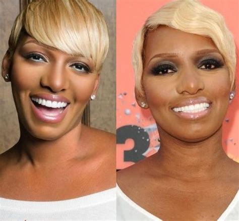 Bad Celebrity Veneers