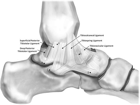 Figure 3 from The ligament anatomy of the deltoid complex of the ankle: a qualitative and ...