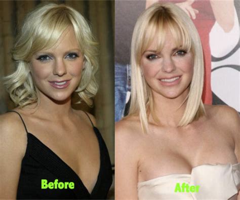 Anna Faris Plastic Surgery before and after pictures - Latest Plastic Surgery Gossip And News ...