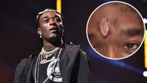 Lil Uzi Vert Has Implanted A $24 Million Diamond Into His Forehead - This Song Is Sick