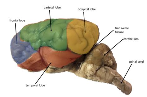 Sheep brain lobes Diagram | Quizlet