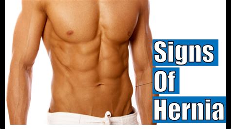 Signs of Hernia | Inguinal hernia symptoms - YouTube