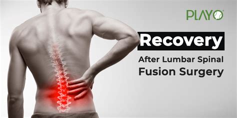 After A Lumbar Spinal Fusion Surgery, Here Is How You Recover | Playo