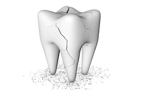 What to do with cracked tooth under the crown of root canal