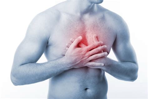 Substernal Chest Pain - Diagnosis, Symptoms, Treatment