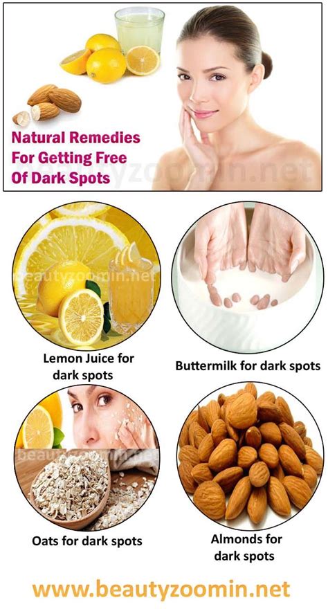 Natural Remedies For Getting Free Of Dark Spots - Beautyzoomin | Brown spots removal, Spots on ...