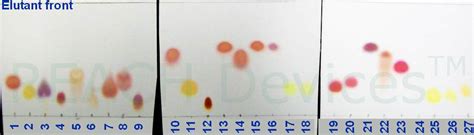 Pre-staining Thin Layer Chromatography Method For Amino, 57% OFF