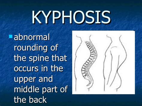 common diseases/disorders of the skeletal system