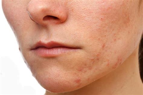 Types of Skin Problems on Face - Top 10 List - Skin Care Geeks