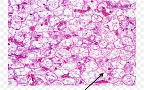 Adipose Connective Tissue Histology