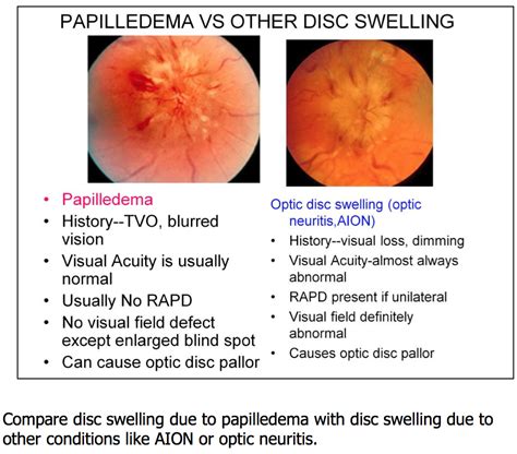 Pin on Ophthalmo