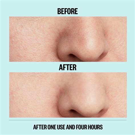 Peace Out Pore Strips Dramatically Shrink Pores in Just 4 Hours | Us Weekly