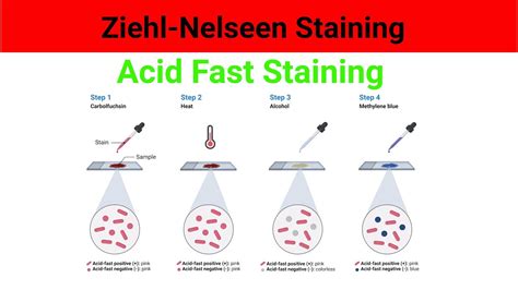 Ziehl-Neelsen Stain (ZN-Stain) Principle, Procedure,, 59% OFF