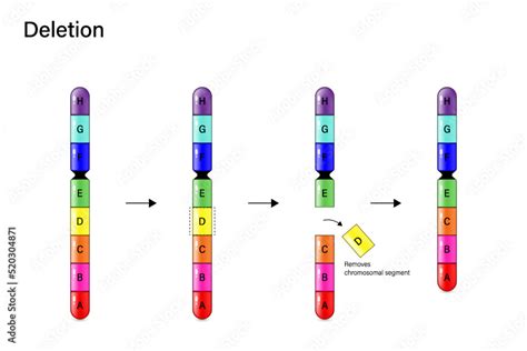 Chromosome Deletion. Genetic mutation. Alteration of chromosome structure. Vector for scientific ...